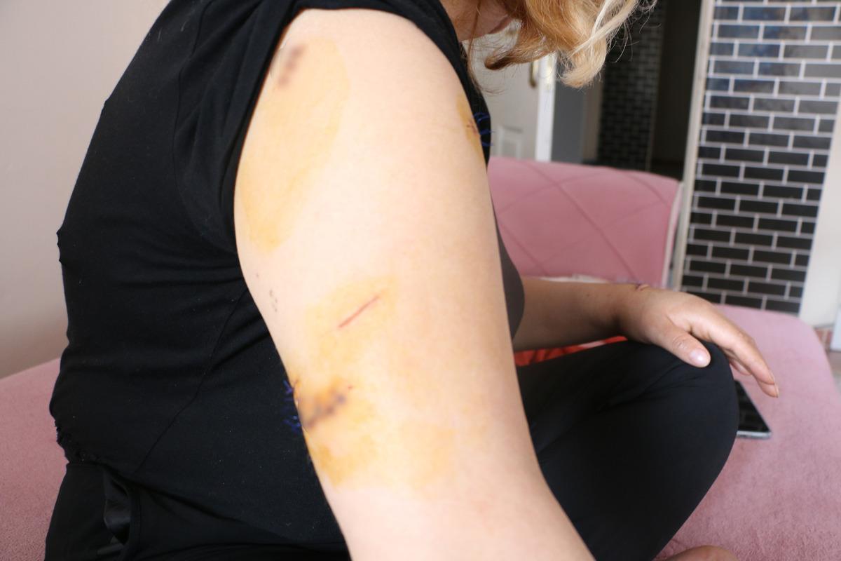 Pusu kurdu, 30 yerinden bı&ccedil;akladı! Eski eş dehşeti 2