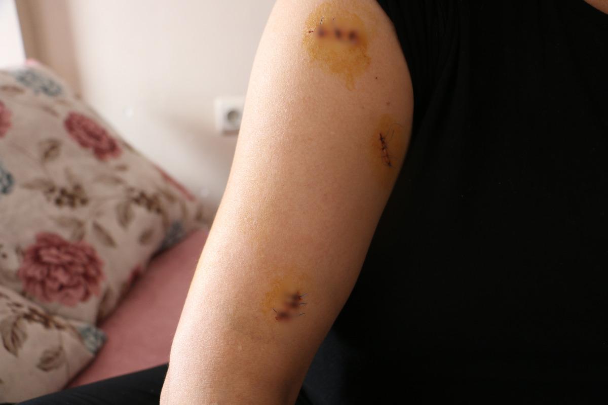 Pusu kurdu, 30 yerinden bı&ccedil;akladı! Eski eş dehşeti 3