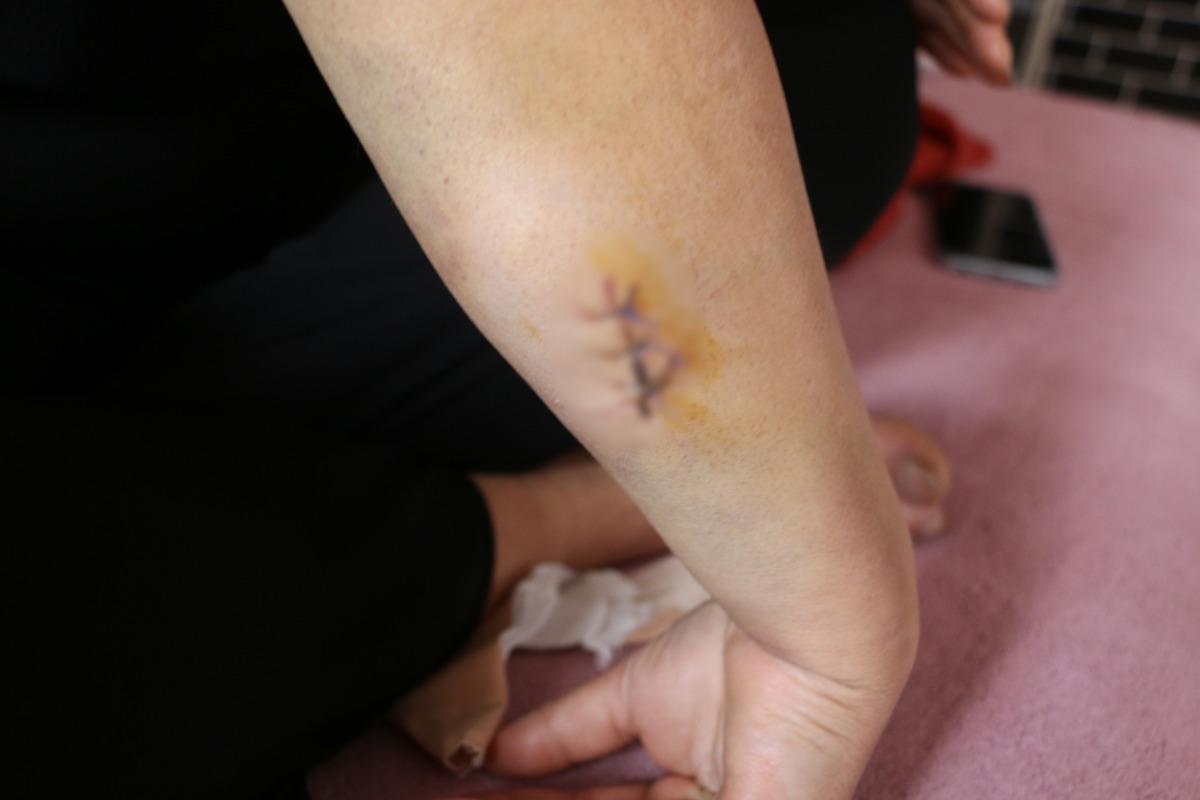 Pusu kurdu, 30 yerinden bı&ccedil;akladı! Eski eş dehşeti 4