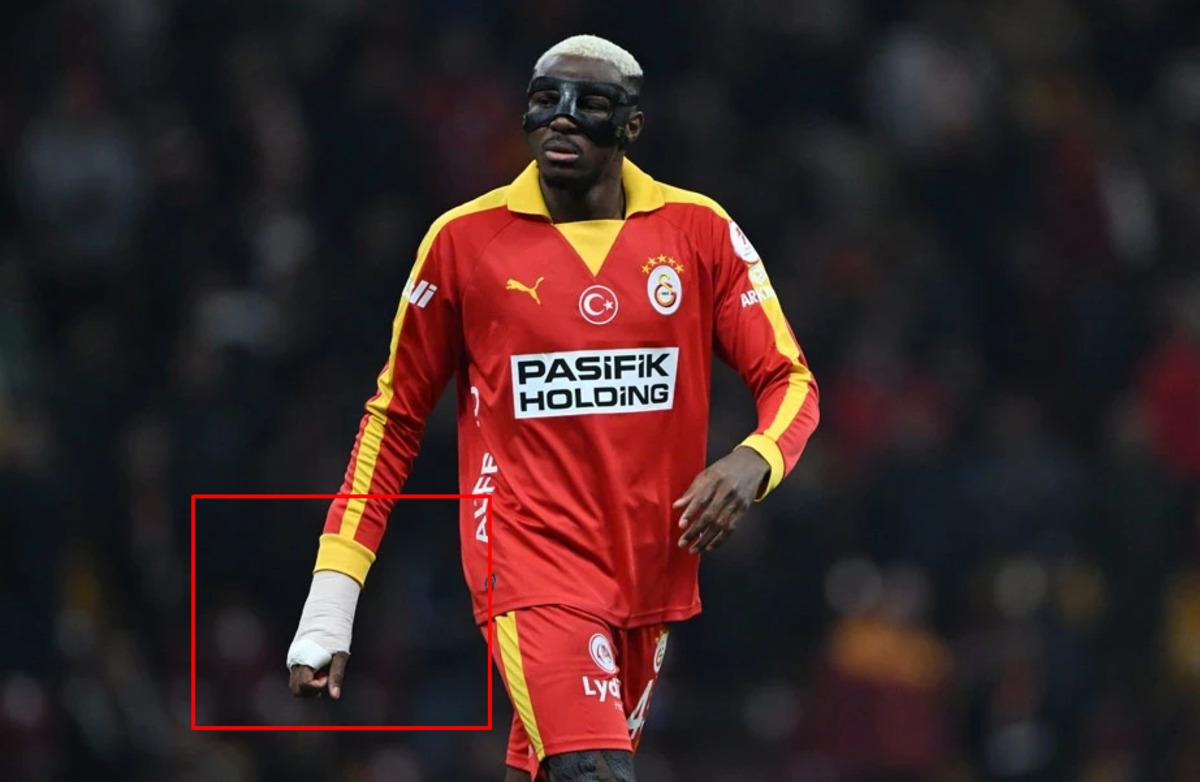 Osimhen in derbide oynayıp oynayamayacağına hakem karar verecek! 1