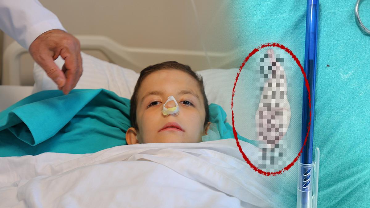 Kulak ağrısıyla gitti: Ağzından dev polip çıkartıldı