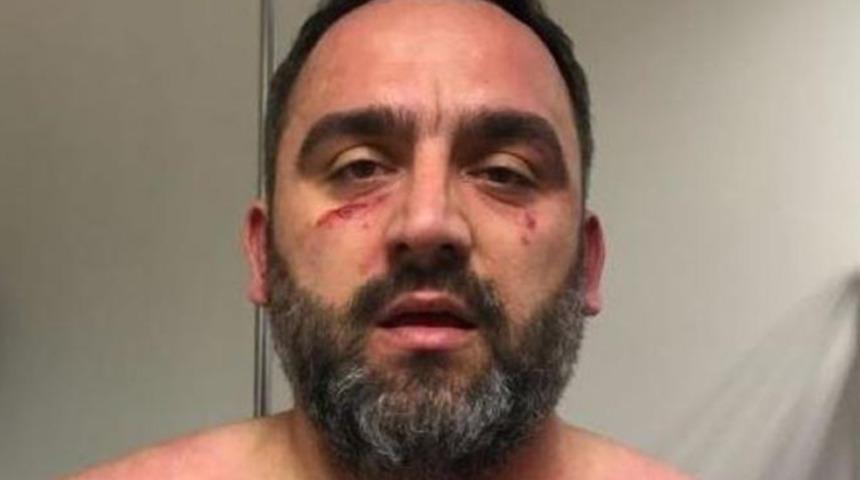 Erdin&ccedil; G&uuml;ltekin: Vura vura beni i&ccedil;eri attılar