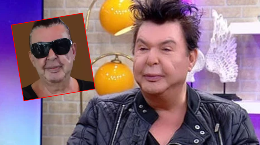 Y&uuml;z&uuml;n&uuml; gerdiren Kuşum Aydın'ın şişlikleri indi! G&ouml;renler aynı yorumu yaptı