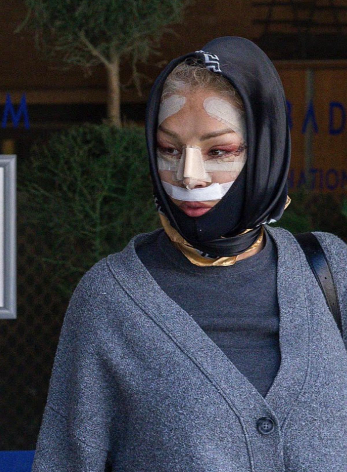 Nadia Almada T&uuml;rkiye&rsquo;deki operasyon sonrası g&ouml;r&uuml;nt&uuml;lendi 2