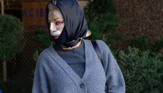 T&uuml;rkiye'de y&uuml;z&uuml;n&uuml; gerdirdi! "Tanınmaz halde"