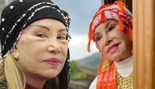 Bedia Akart&uuml;rk y&uuml;z&uuml;n&uuml; gerdirmişti! Son hali ortaya &ccedil;ıktı