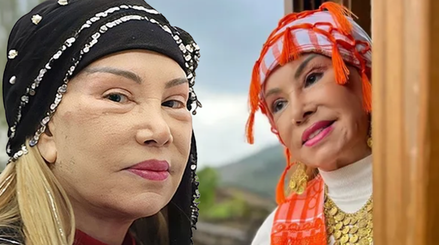 Bedia Akart&uuml;rk y&uuml;z&uuml;n&uuml; gerdirmişti! Son hali ortaya &ccedil;ıktı