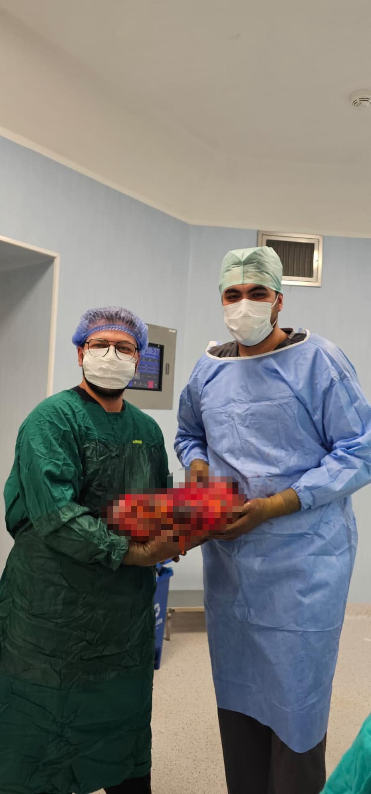 Karnından 8 kiloluk b&ouml;brek &ccedil;ıktı! Doktorlar bile şaşırdı 3