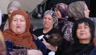 İzmir'de bir gen&ccedil; kız burun ameliyatı sonrası &ouml;ld&uuml;! 