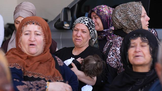 İzmir'de bir genç kız burun ameliyatı sonrası öldü! 