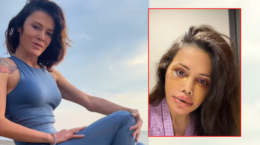 Didem Ceran son halini paylaştı: &ldquo;Bu y&uuml;z ka&ccedil; yaşında?"