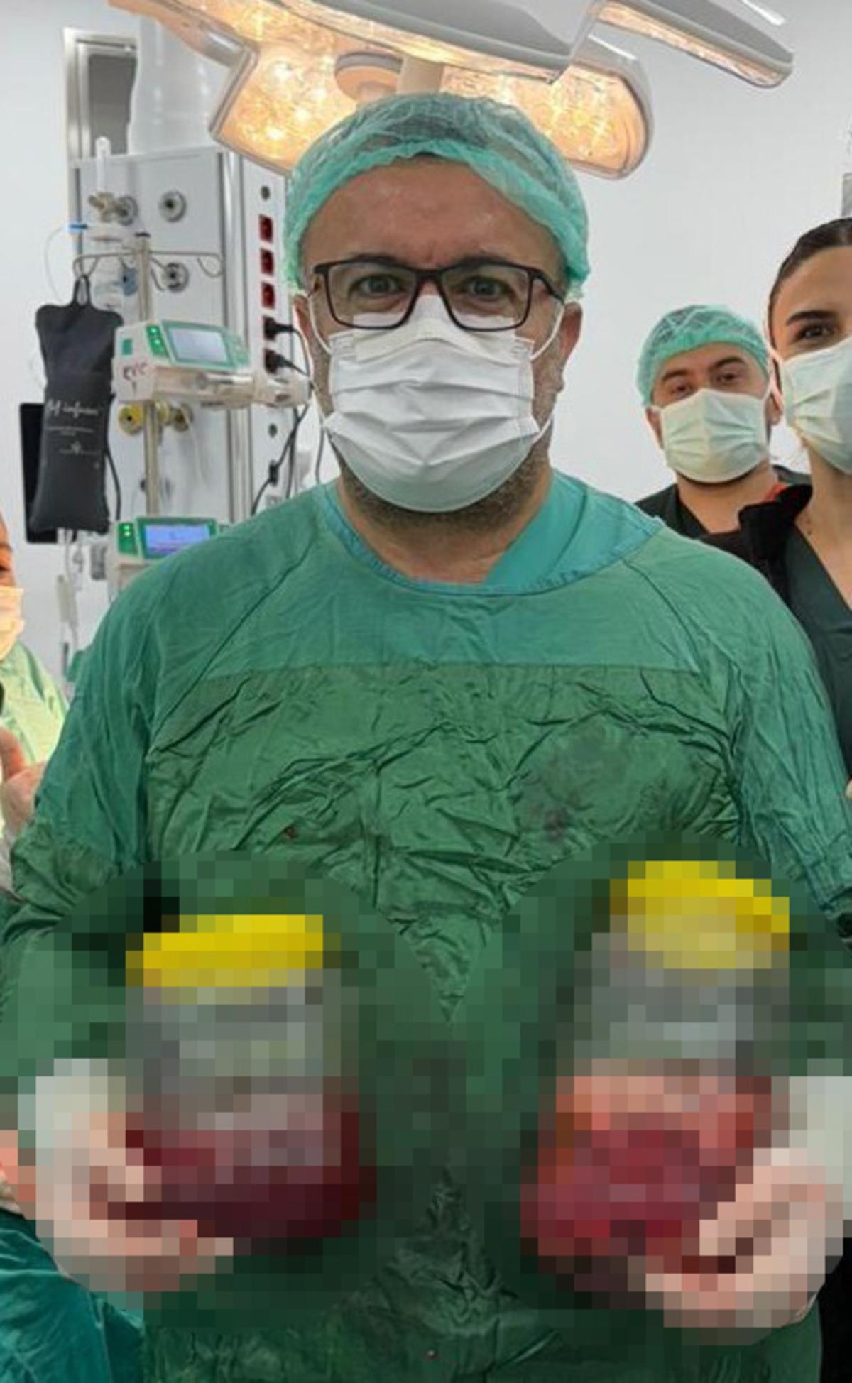 Kilo kaybı diye gitti: B&ouml;breğinden 20 santimlik t&uuml;m&ouml;r &ccedil;ıkarıldı! 1