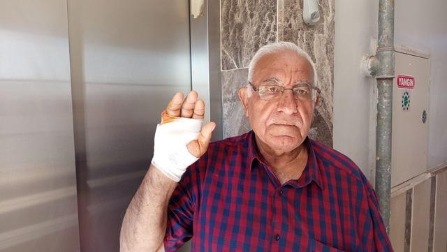Komşusu parmağını ısırarak kopardı