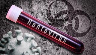 DS&Ouml; a&ccedil;ıkladı! İsvi&ccedil;re&rsquo;de hantavir&uuml;s vakası tespit edildi