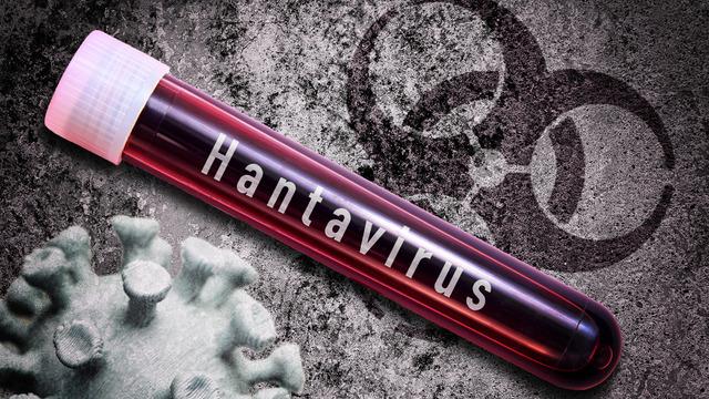 DSÖ açıkladı! İsviçre’de hantavirüs vakası tespit edildi