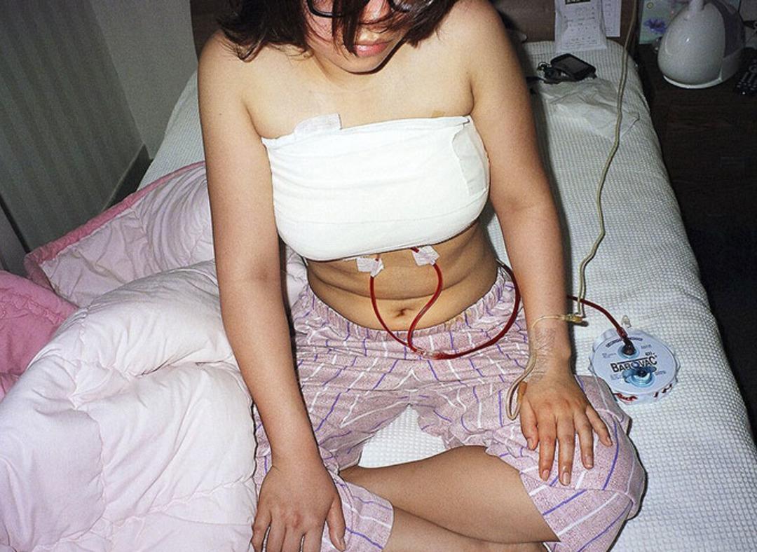 G&uuml;ney Kore`nin estetik &ccedil;ılgınlığı 