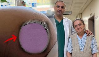 "Kabızlık sanıyordum" dedi: Karnından 22 kiloluk dev t&uuml;m&ouml;r &ccedil;ıktı