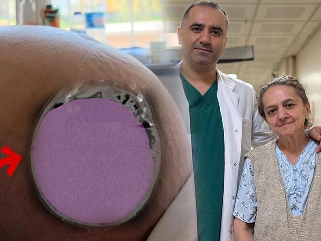 "Kabızlık sanıyordum" dedi: Karnından 22 kiloluk dev t&uuml;m&ouml;r &ccedil;ıktı