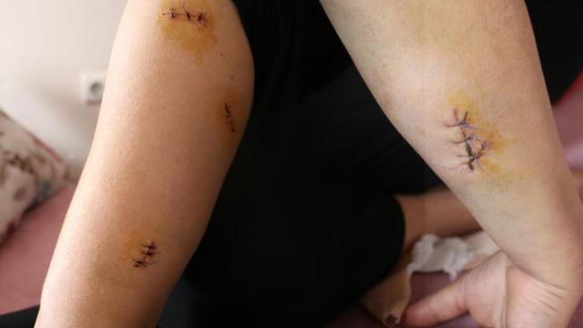 Kocası 30 yerinden bıçakladı! Görümcesinden akılalmaz istek