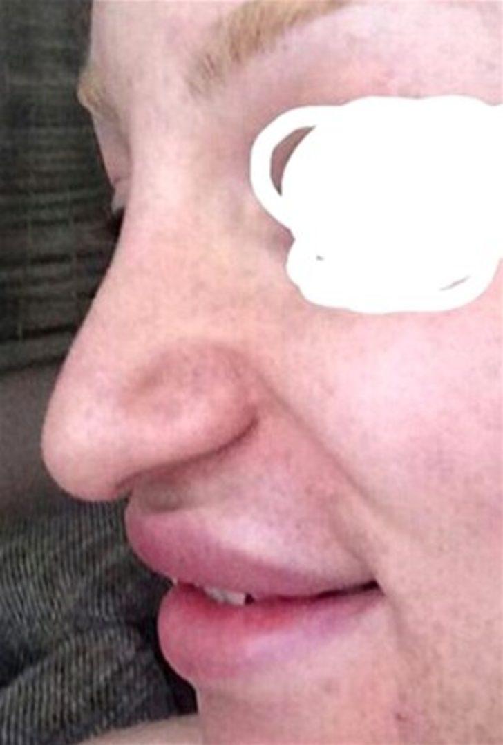 Bambaşka biri oldu  G3