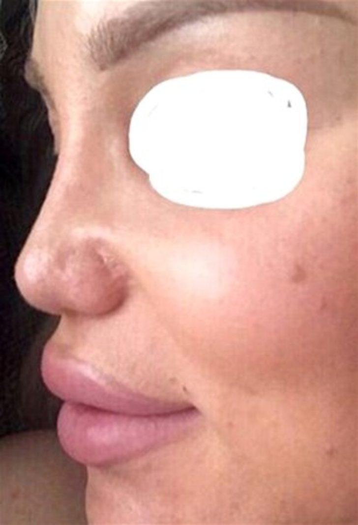 Bambaşka biri oldu  G5