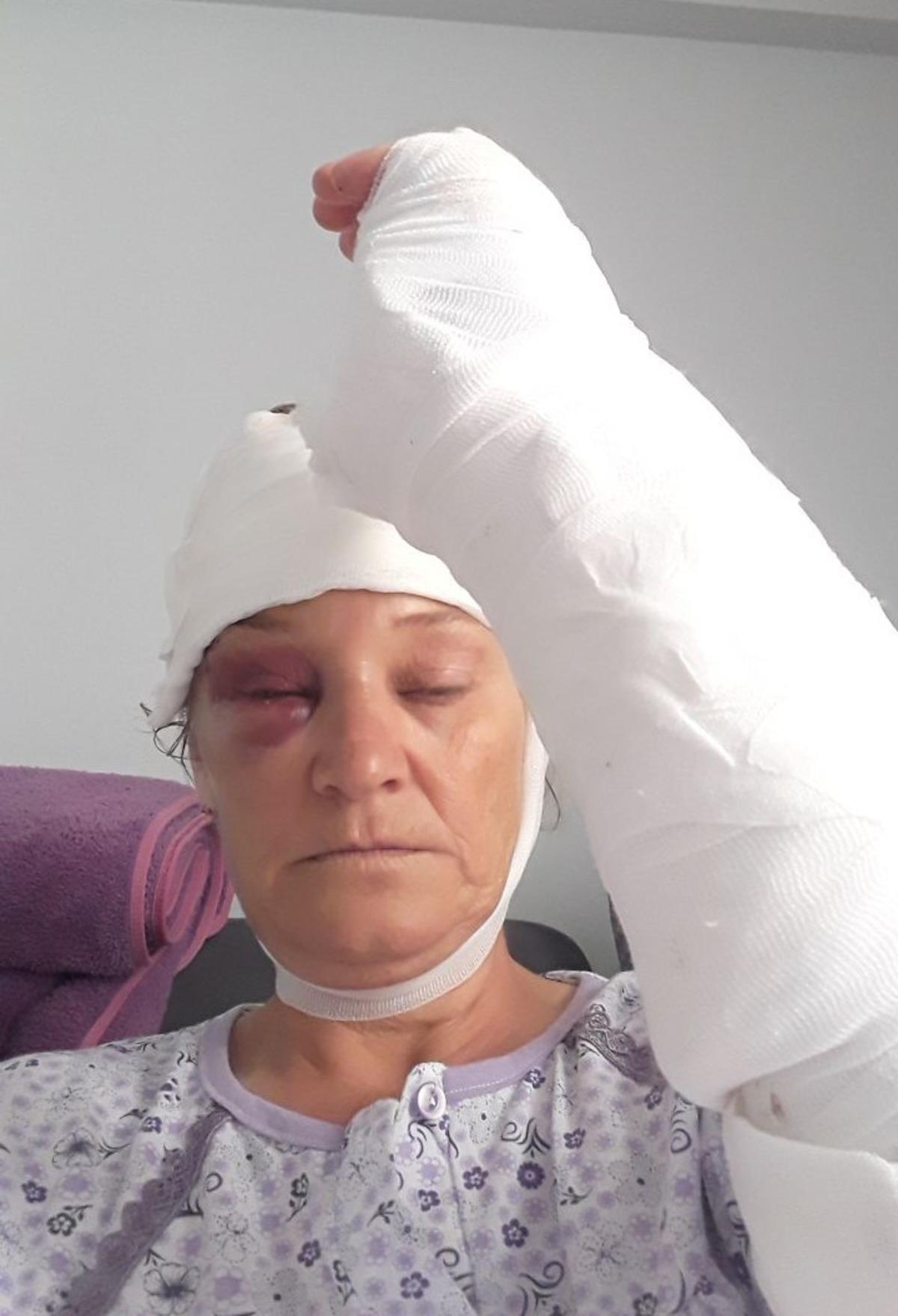 Patronun k&ouml;peği dehşet sa&ccedil;tı: V&uuml;cuduna 80 dikiş atıldı! Neredeyse &ouml;l&uuml;yordu 6