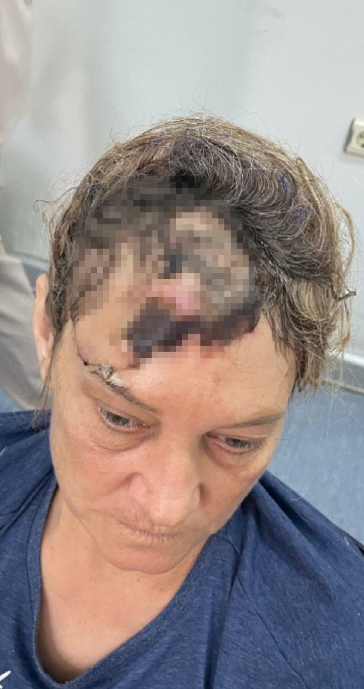 Patronun k&ouml;peği dehşet sa&ccedil;tı: V&uuml;cuduna 80 dikiş atıldı! Neredeyse &ouml;l&uuml;yordu 3