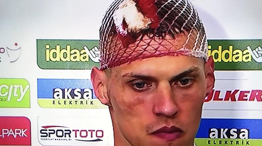 Sktrel'in kafası yarıldı, sosyal medya karıştı