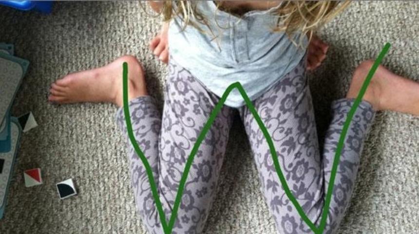 Çocuğunuz bu şekilde oturuyorsa dikkat!