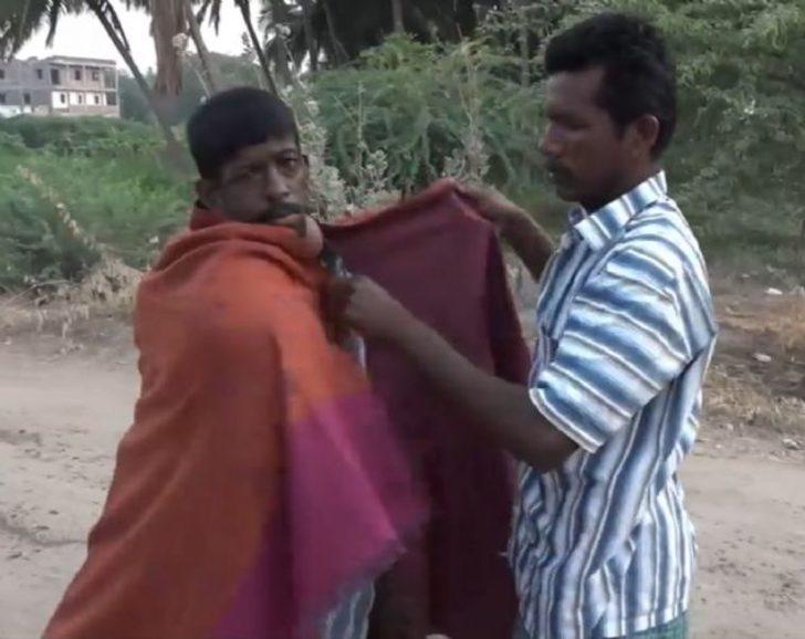 Vücudundaki dev tümör onu bu hale getirdi G1