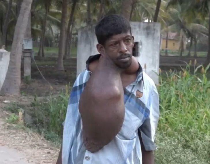 Vücudundaki dev tümör onu bu hale getirdi G3