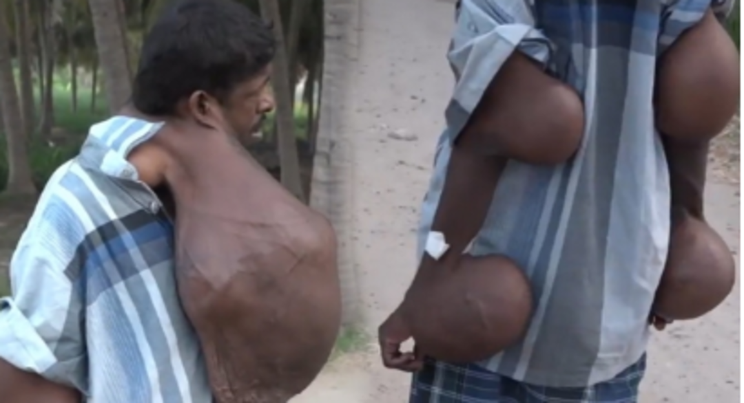 Doktorlar &ccedil;are bulamıyor