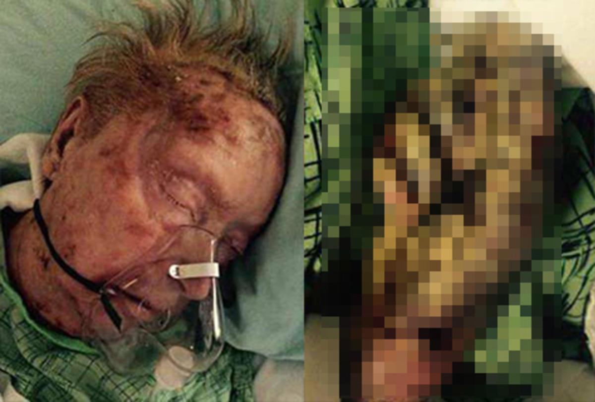 Yaşlı kadını b&ouml;cekler yedi! B&ouml;yle &ouml;l&uuml;m g&ouml;r&uuml;lmedi