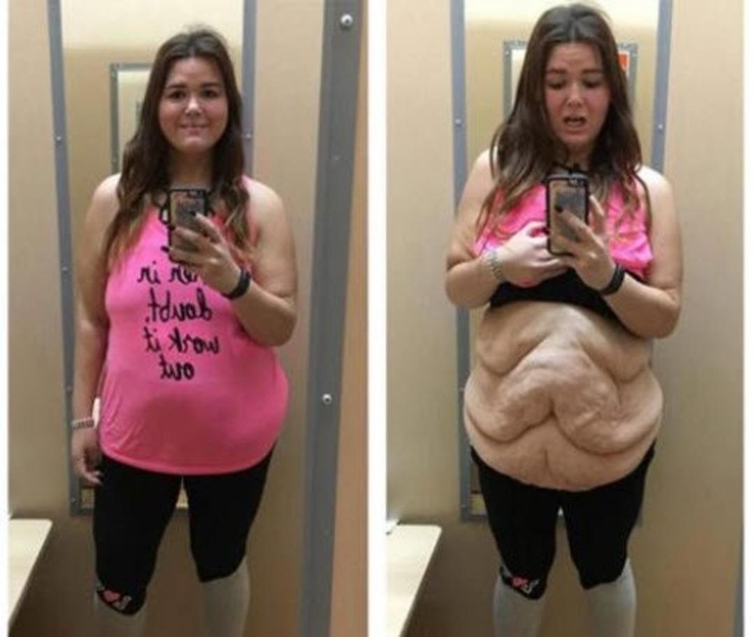 100 kilo verdi şimdi g&ouml;renler g&uuml;zelliğine hayran kalıyor! 