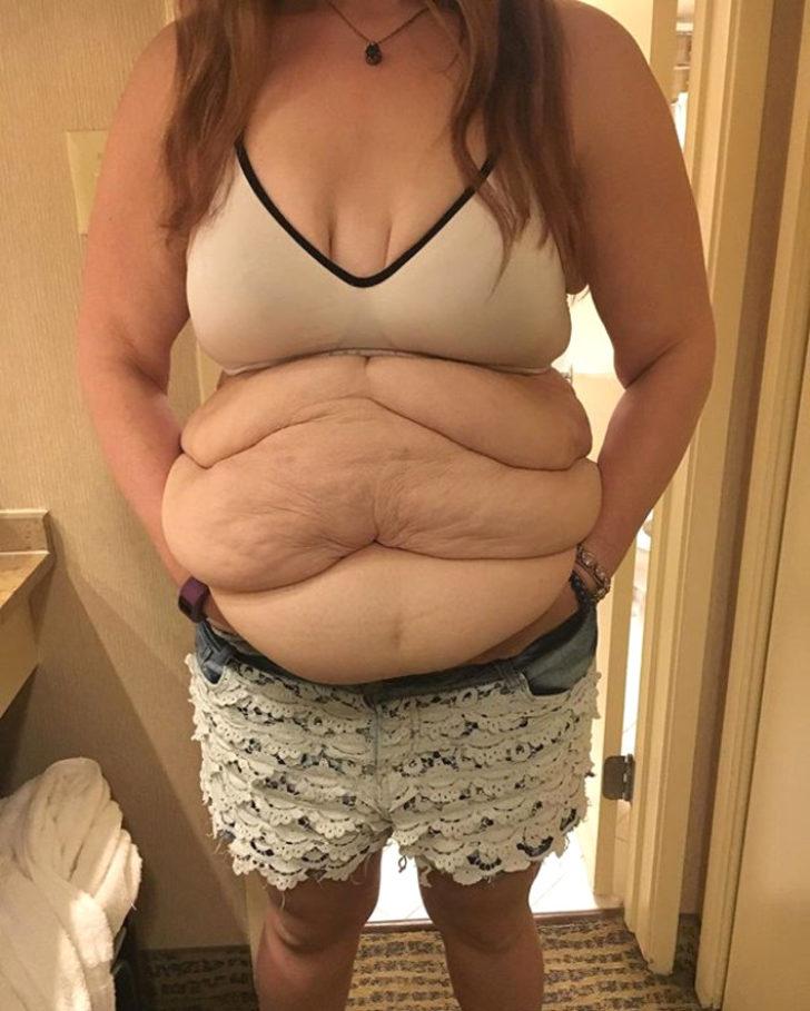 Son halini gören tanıyamıyor G5