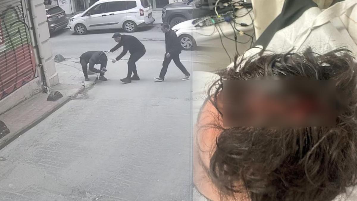 Yer: İstanbul! Yolda yürürken ölümden döndü: 7 dikiş atıldı - Gündem Haberleri