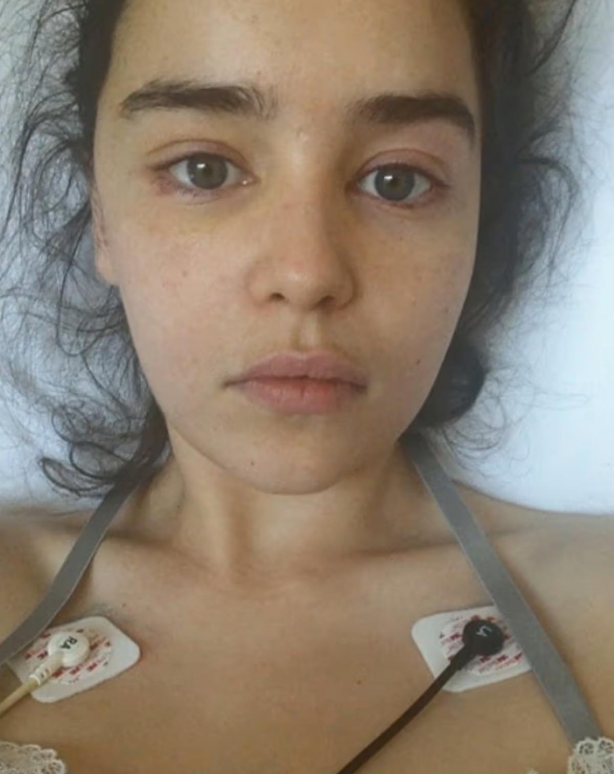 Emilia Clarke yıllar sonra a&ccedil;ıkladı: 35 yaşında yumurtalarını dondurdu 2
