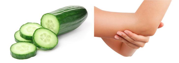 Koyu diz ve dirseklerden kurtulmanın etkili yolları G1