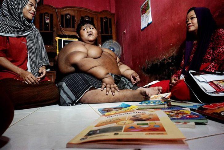 Dünyanın en şişman çocuğuydu, tam 80 kilo verdi! G1