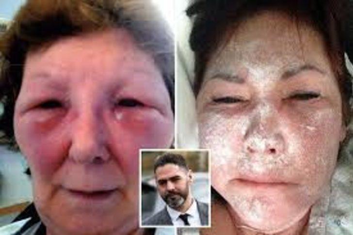 Ozan Melin İngiltere'yi karıştırdı! 'Doktorum' dedi, kadınları bu hale getirdi G1