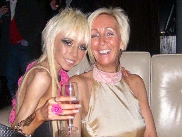 Anoreksiyanın pençesindeki kadın yaşadığı mucizeyle hayata tutundu G3