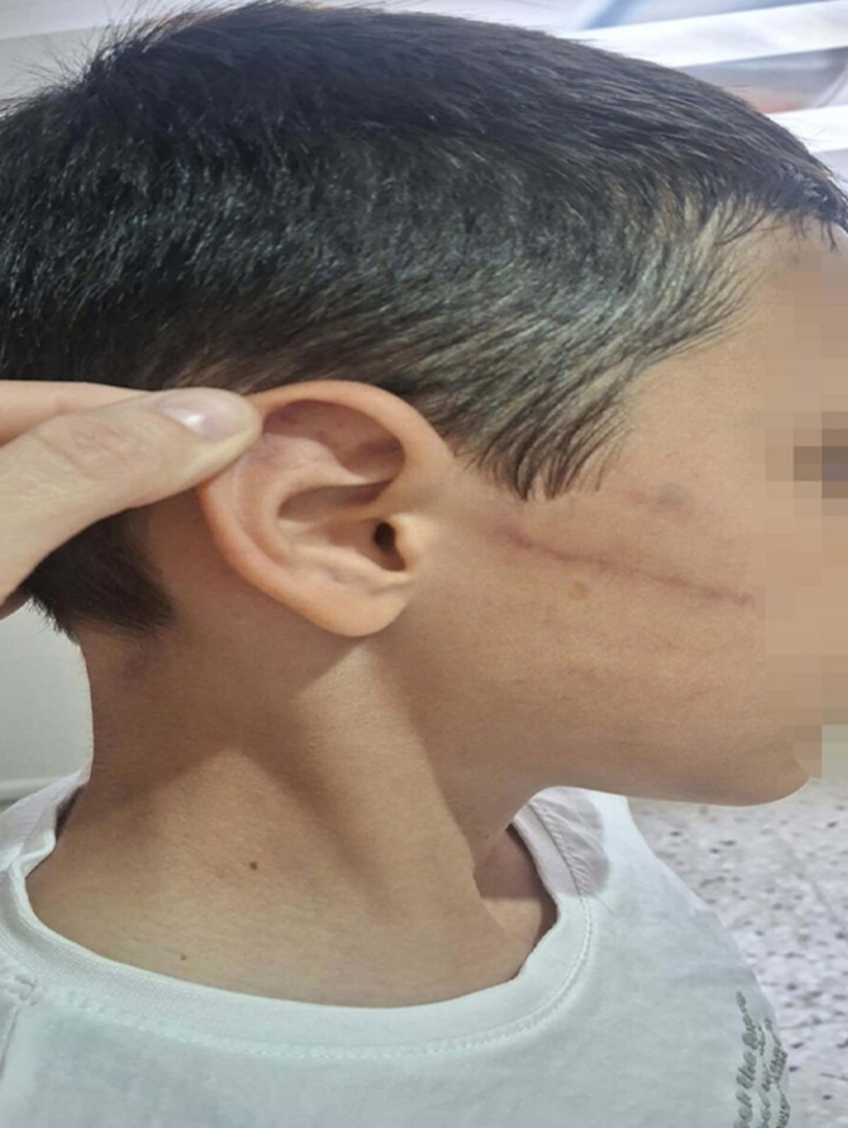Babasının darbettiği 12 yaşındaki çocuk koruma altına alındı 1
