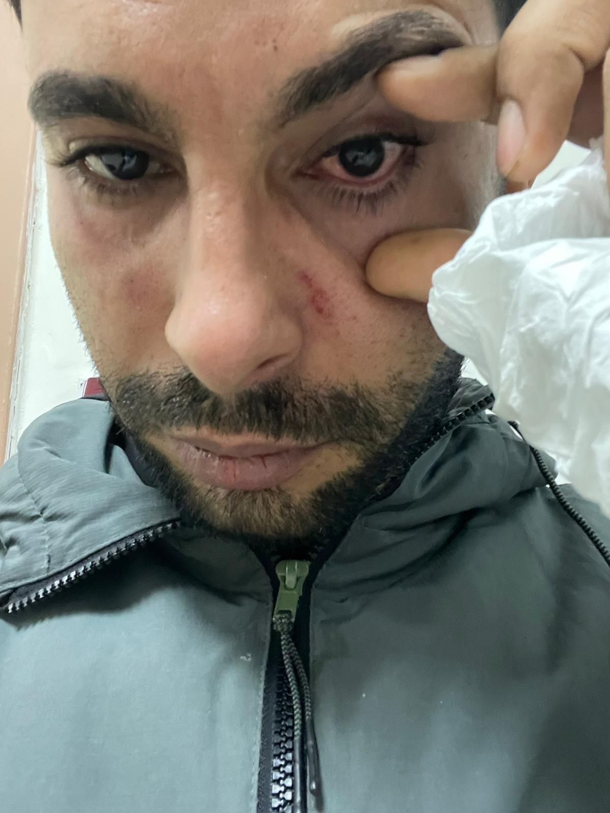 Doktor hastaya yumruk attı! Yüzde 30 görme kaybı... 2