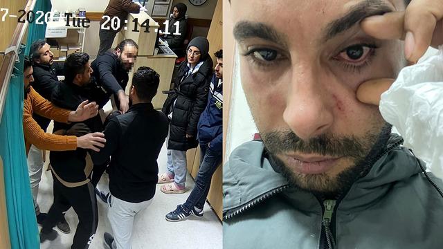 Doktor hastaya yumruk attı! Yüzde 30 görme kaybı...