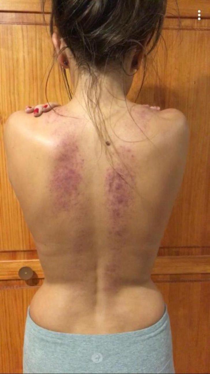 Herkes ilgi çekmek istediğini sanıyordu! İnanılmaz gerçeği öğrenince... G5