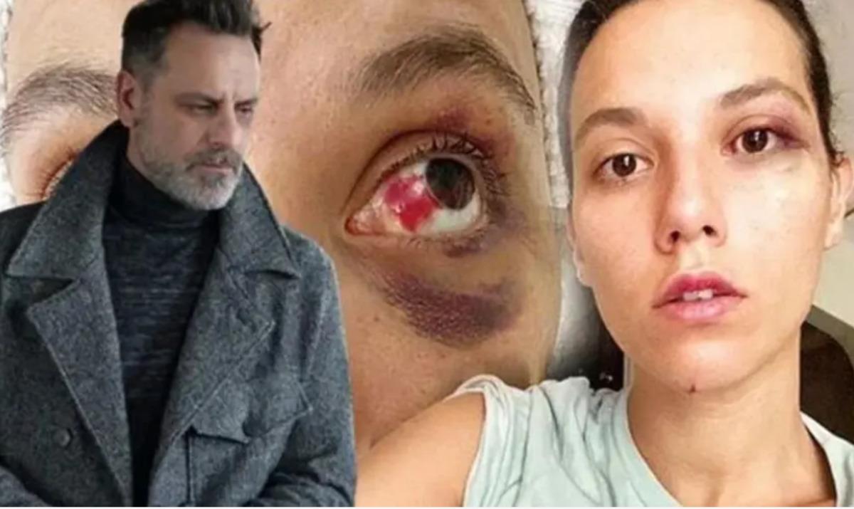 Ozan Güven e kadınlar tepki gösterdi! Kafeyi terk etmek zorunda kaldı 2