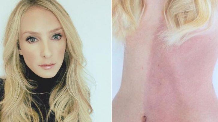 Doğum lekesi sandığı iz ikizi çıktı!  Meğer yıllardır bedeninde taşıyormuş G1