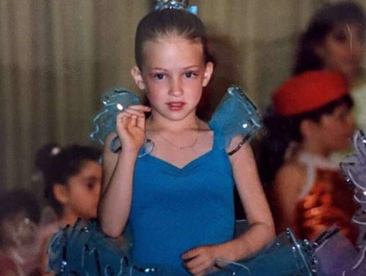 Doğum lekesi sandığı iz ikizi çıktı!  Meğer yıllardır bedeninde taşıyormuş G2