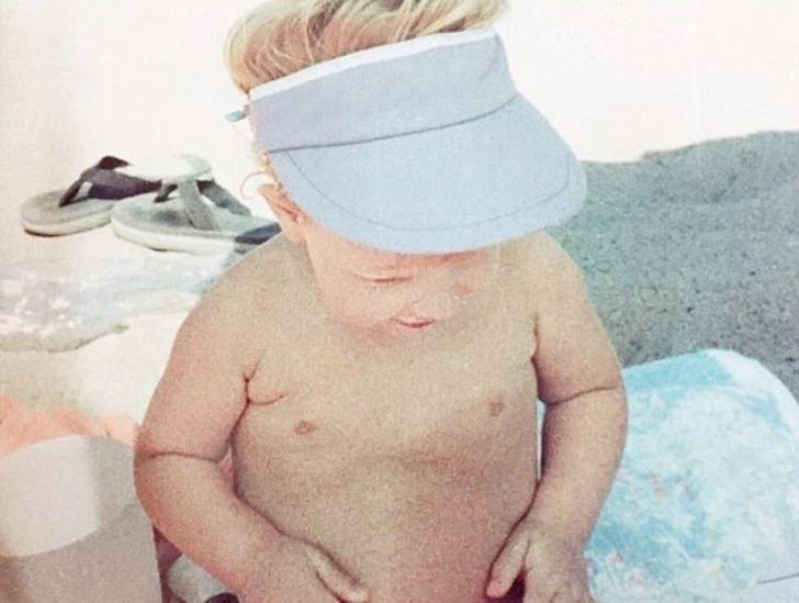 Doğum lekesi sandığı iz ikizi çıktı!  Meğer yıllardır bedeninde taşıyormuş G3