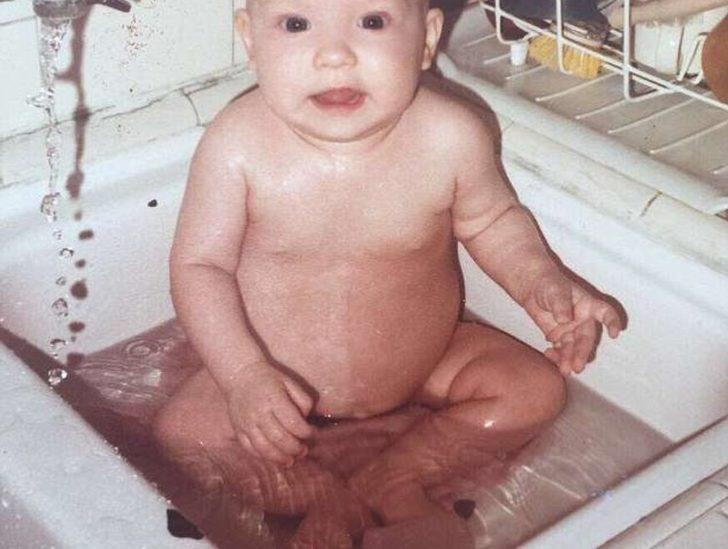 Doğum lekesi sandığı iz ikizi çıktı!  Meğer yıllardır bedeninde taşıyormuş G4